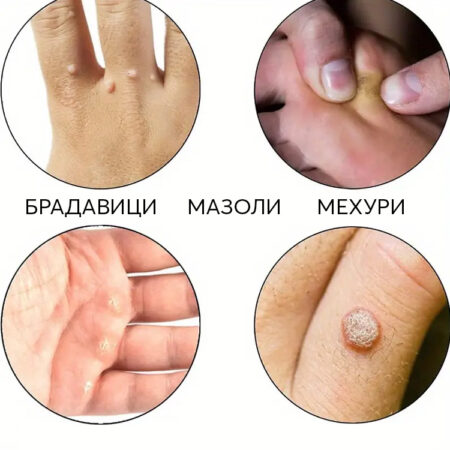 Начална страница 12 Подложки за премахване на брадавици-кокоши трън,мазоли и мехури 15бр. – снимка 2
