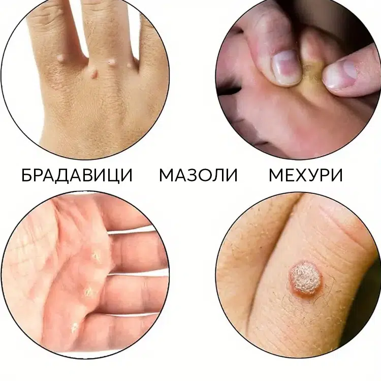 INSOLESCOMFORTFOOT60