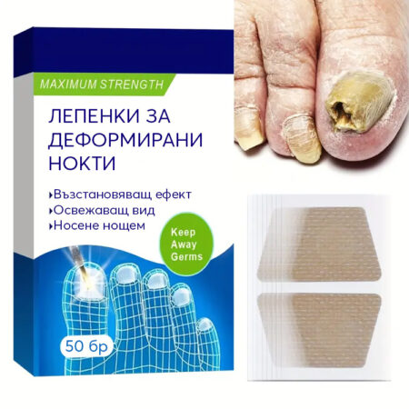 Начална страница 14 Лепенки за деформирани и впити нокти 50-бр.